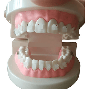 Modelo Ortodoncia Enseñanza Estéticos Autoligados Santiago