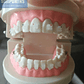 Modelo Ortodoncia Enseñanza Estéticos Autoligados Santiago - Miniatura 2
