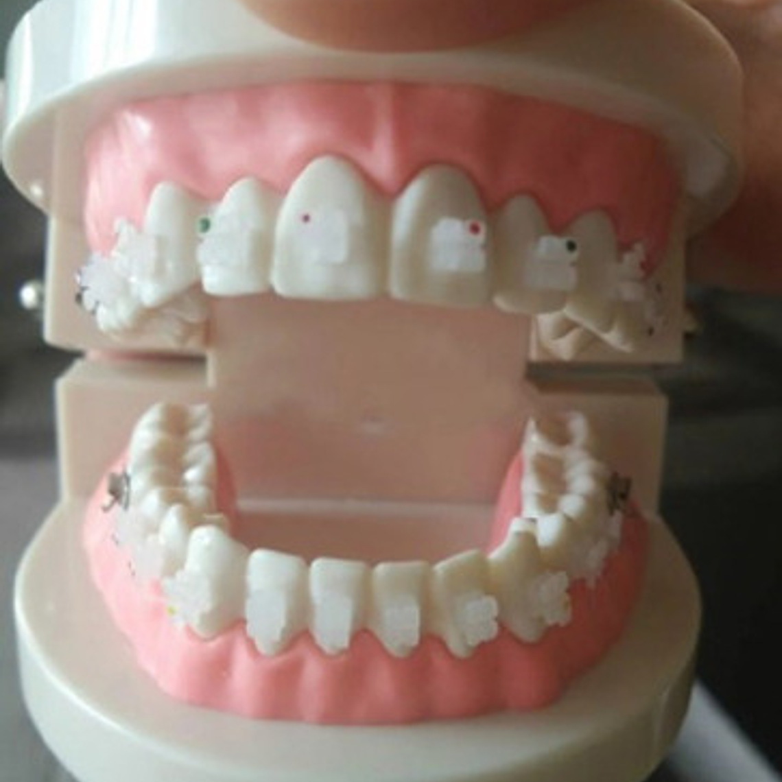 Modelo Ortodoncia Enseñanza Estéticos Autoligados Santiago 3