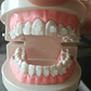 Modelo Ortodoncia Enseñanza Estéticos Autoligados Santiago - Miniatura 3