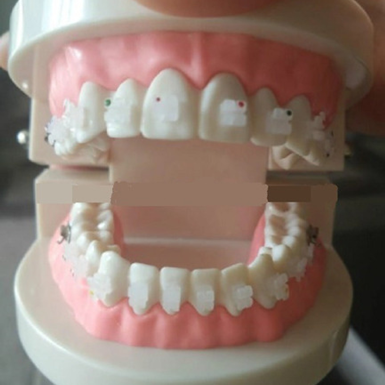 Modelo Ortodoncia Enseñanza Estéticos Autoligados Santiago 4