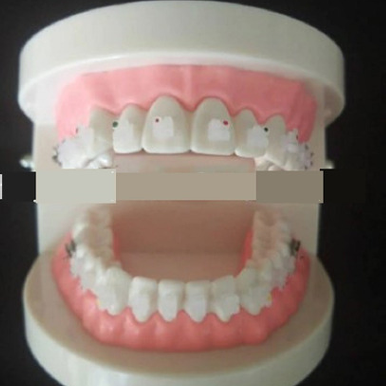 Modelo Ortodoncia Enseñanza Estéticos Autoligados Santiago 5