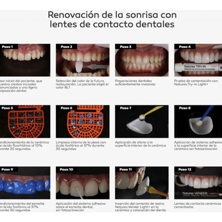 Cemento Resinoso Fotocurado Natures Veneer Bm4 2g 3