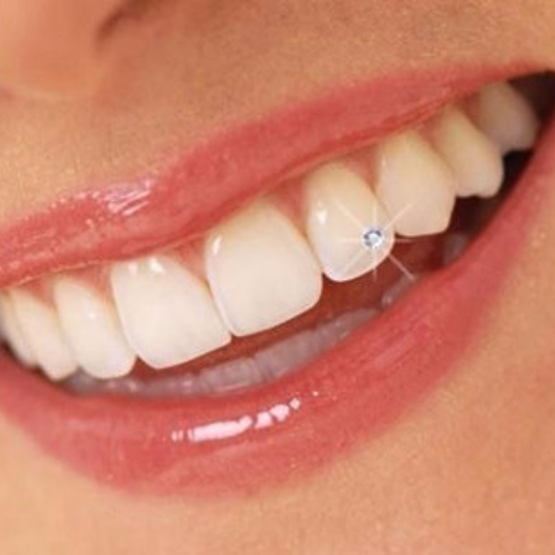 Piercing Dental Maquira Cristales Lapidados Set 10u Brillo Elegante 2