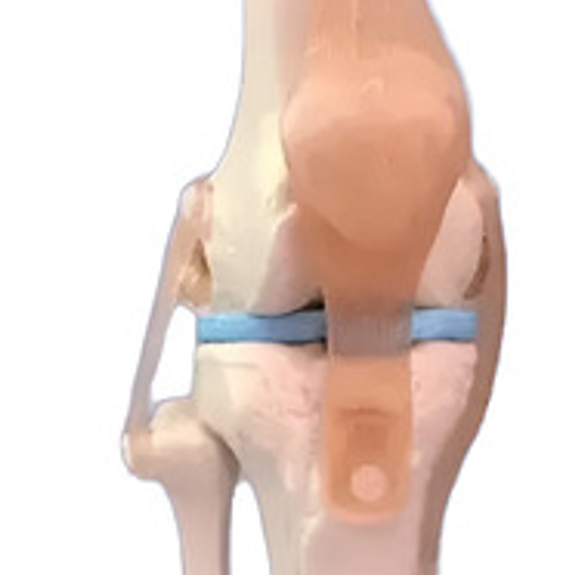 Modelo Anatómico De Estudio Rodilla Ligamentos 33cms 6