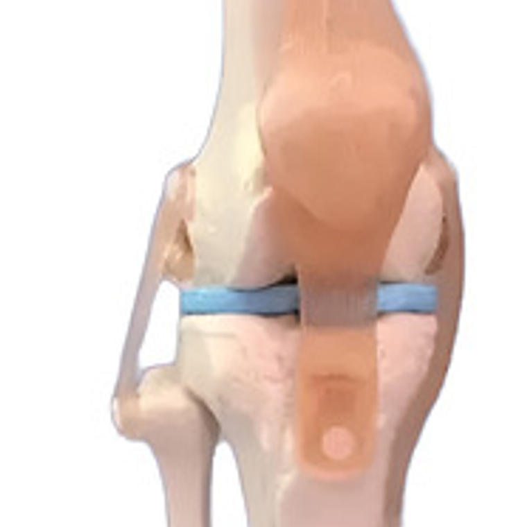 Modelo Anatómico De Estudio Rodilla Ligamentos 33cms 6