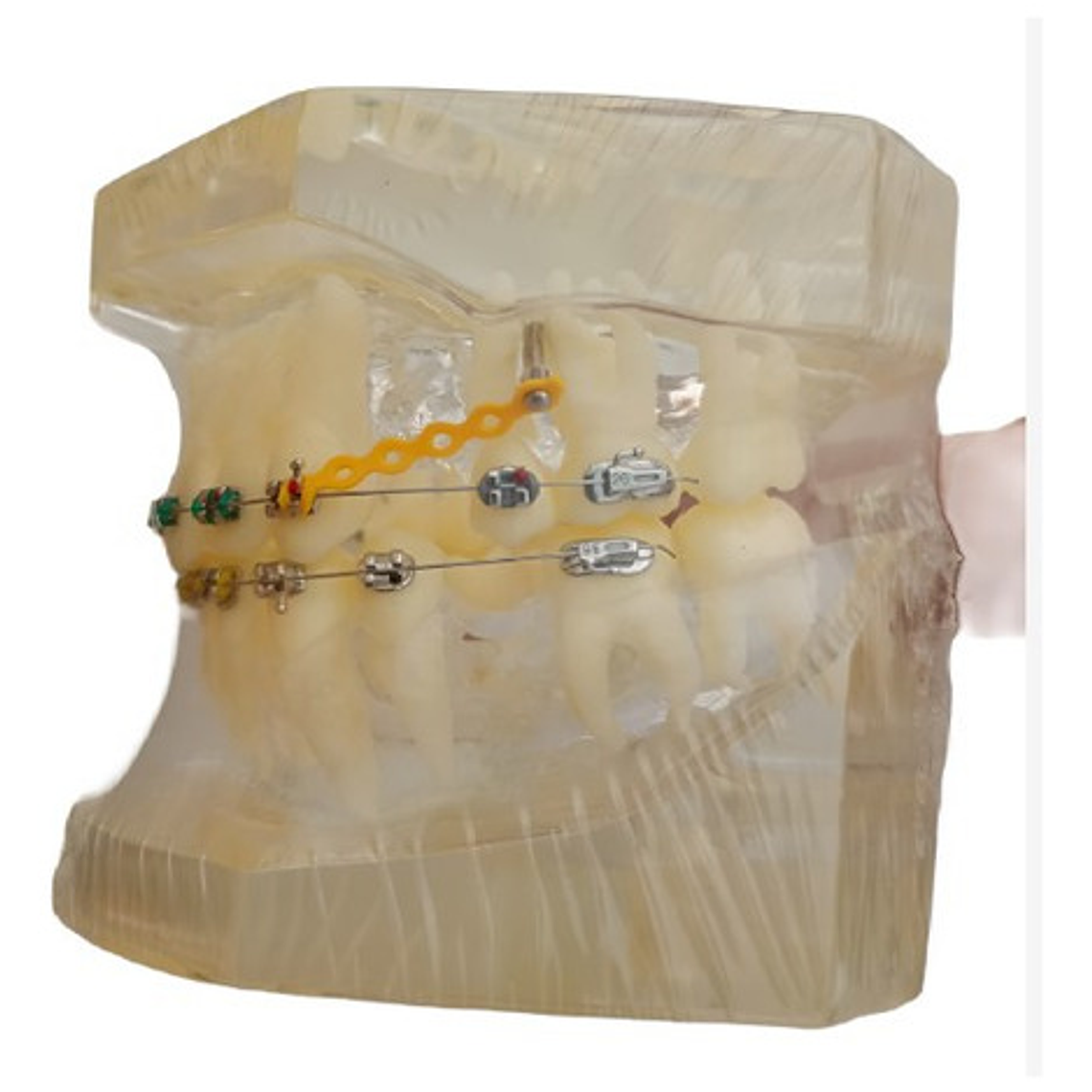 Modelo Dental Ortodoncia Brackets Normal Acrílico Transp. 3