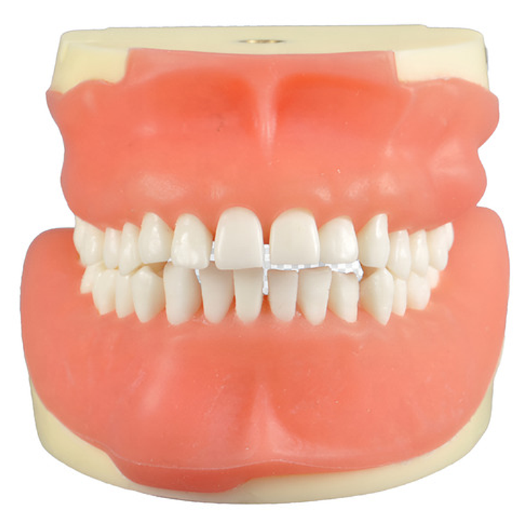 Modelo Anatómico Bucal Cirugía Oral Colgajos Quiste Incluido 2