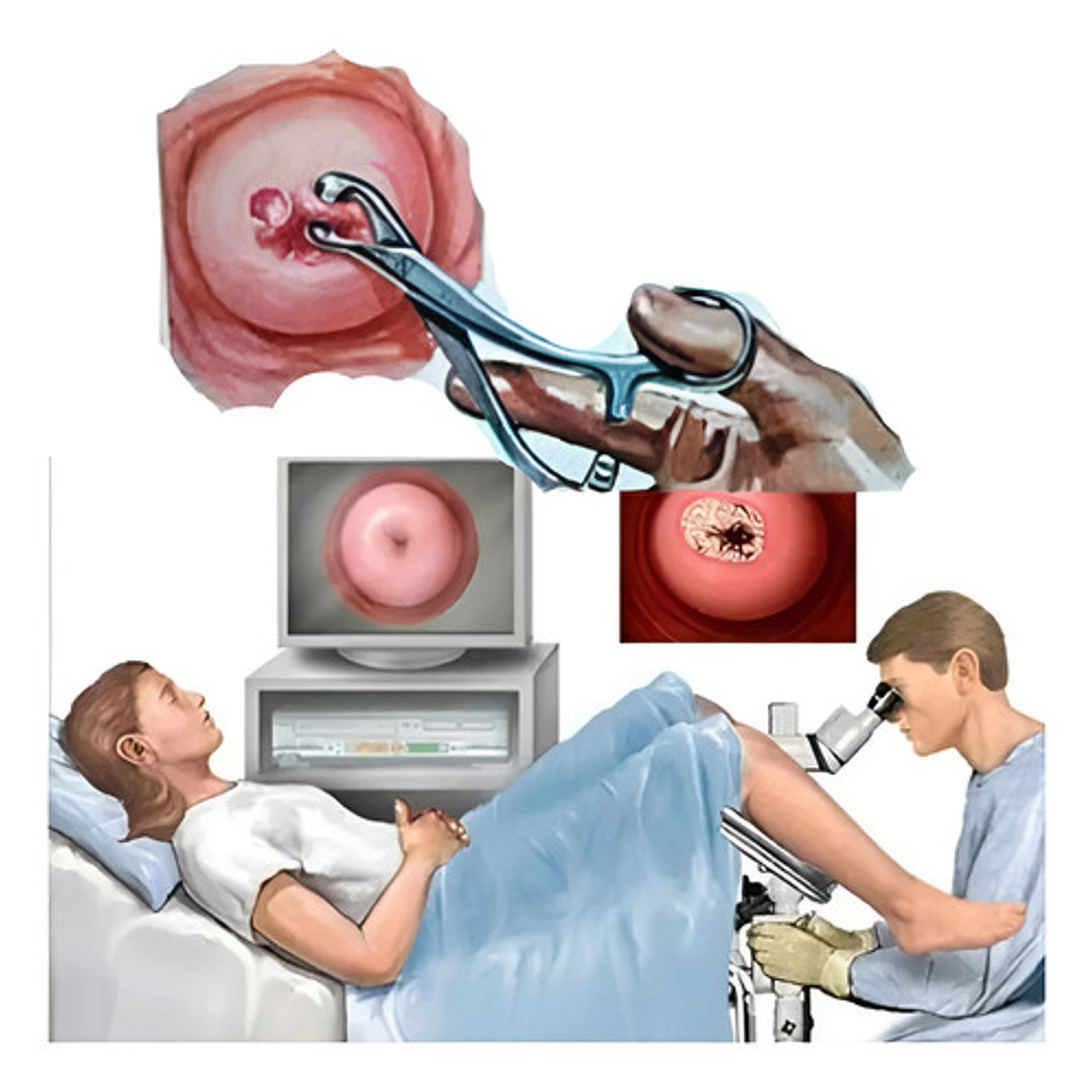 Pinza Pozzi 23cms Original Pacard, Ginecología 7