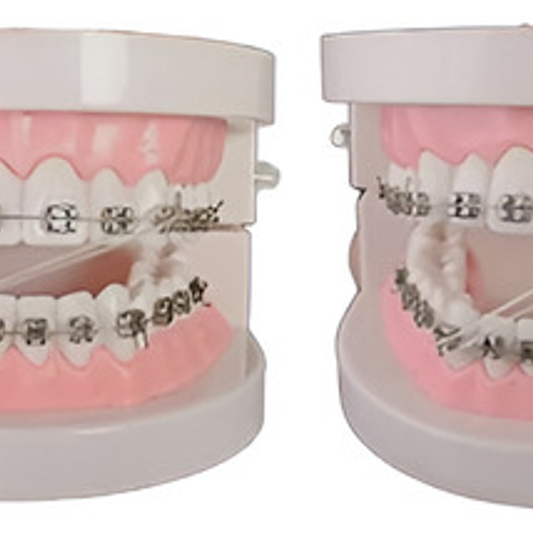 Posicionador Elásticos Intermaxilares Ortodoncia X 50 Stgo 2