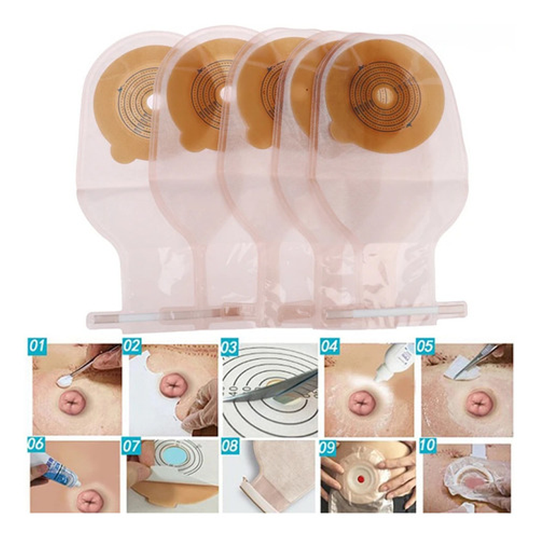 10x Bolsa Colostomia Placa Aro Ostomia 65mm Anti Olor Gases Color Crema 4