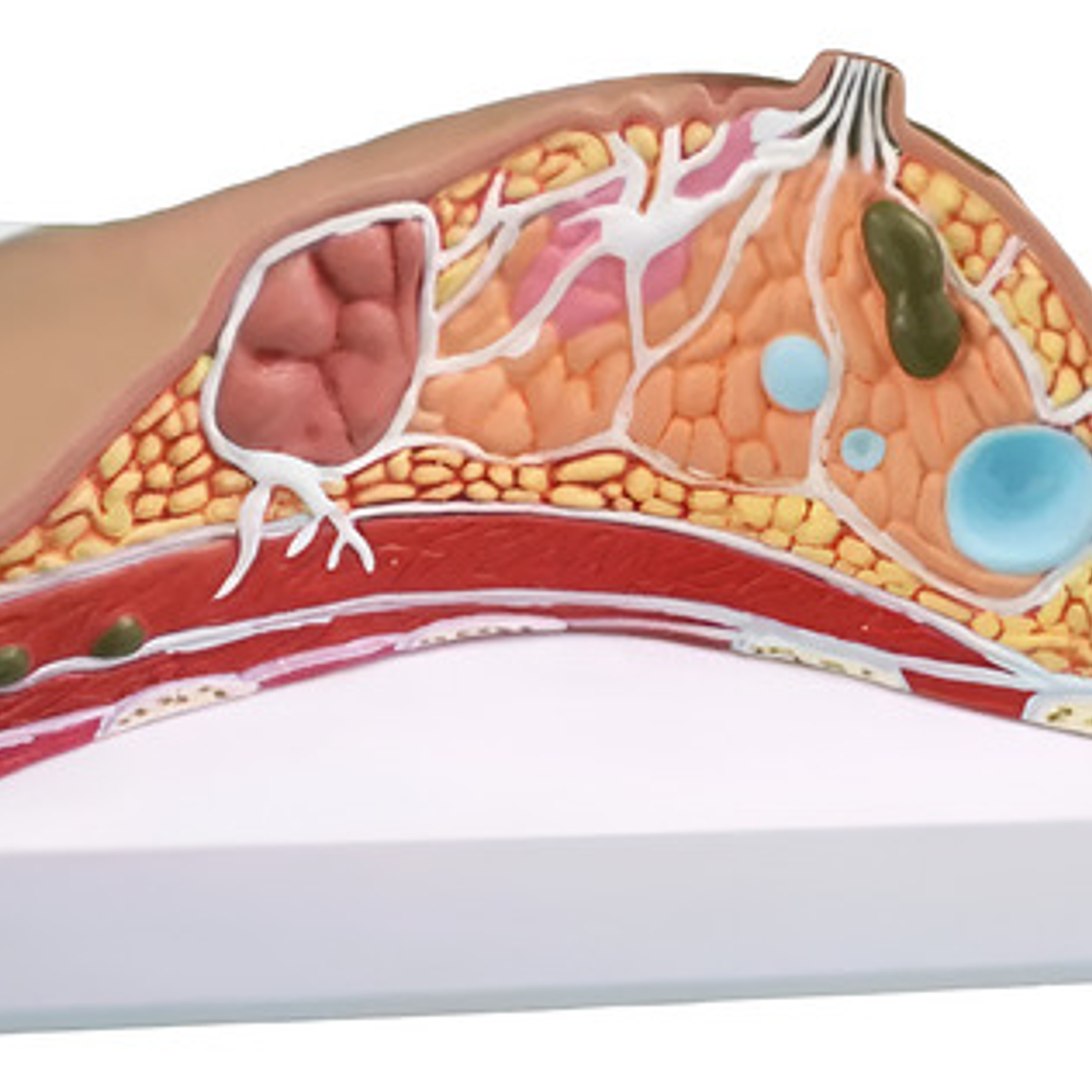 Modelo Anatómico De Mama Con Patologías Mas Comunes Completo 1