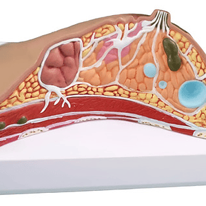 Modelo Anatómico De Mama Con Patologías Mas Comunes Completo