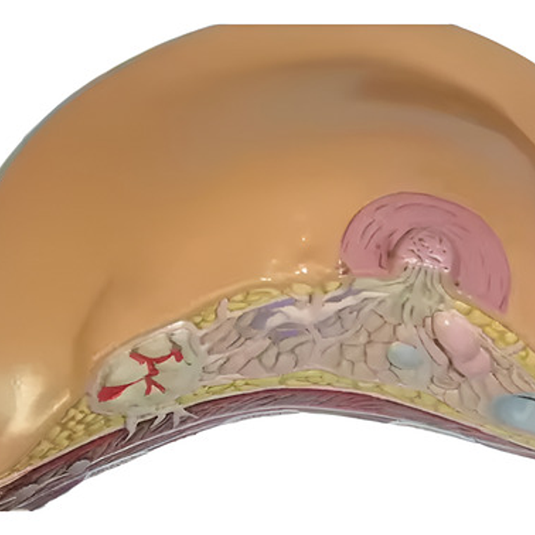 Modelo Anatómico De Mama Con Patologías Mas Comunes Completo 2