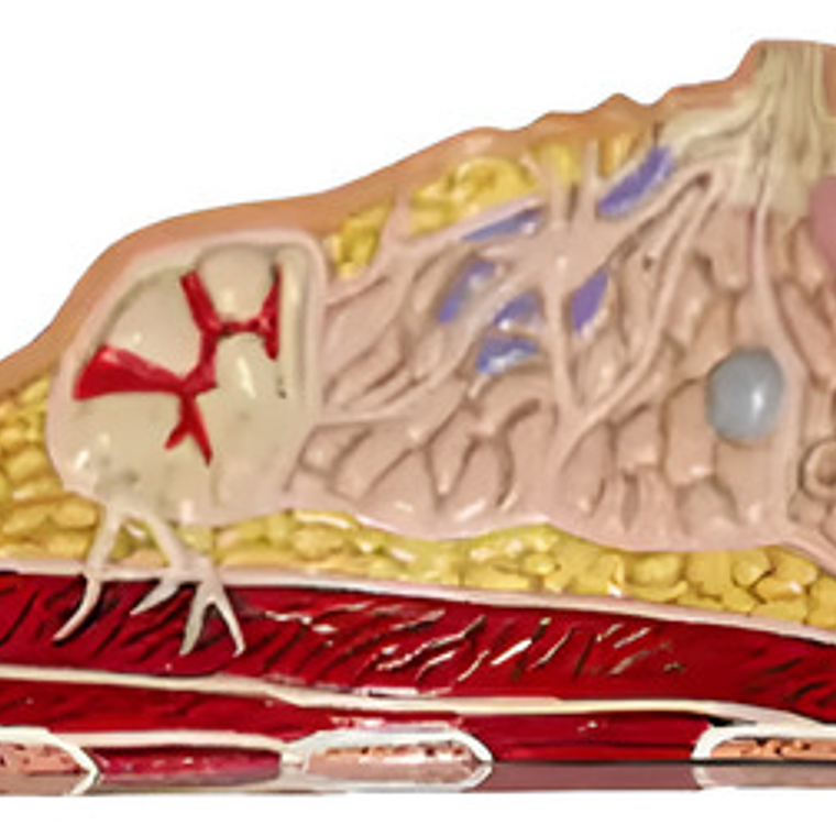 Modelo Anatómico De Mama Con Patologías Mas Comunes Completo 6
