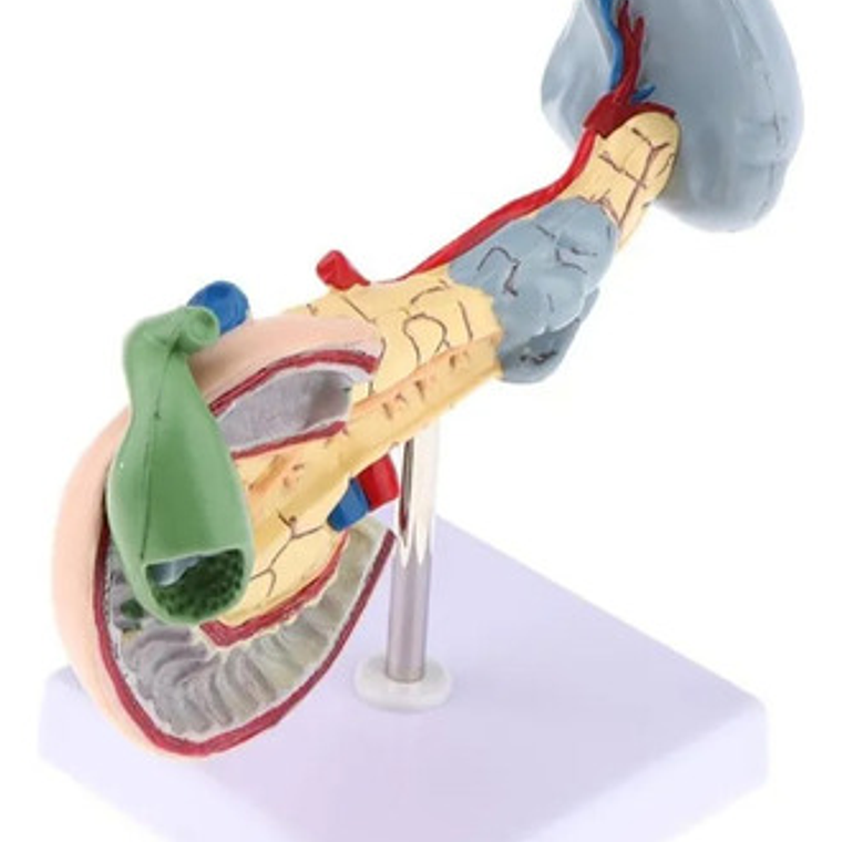Modelo Patológico De Páncreas Vesícula Duodeno Bazo 20cms 6