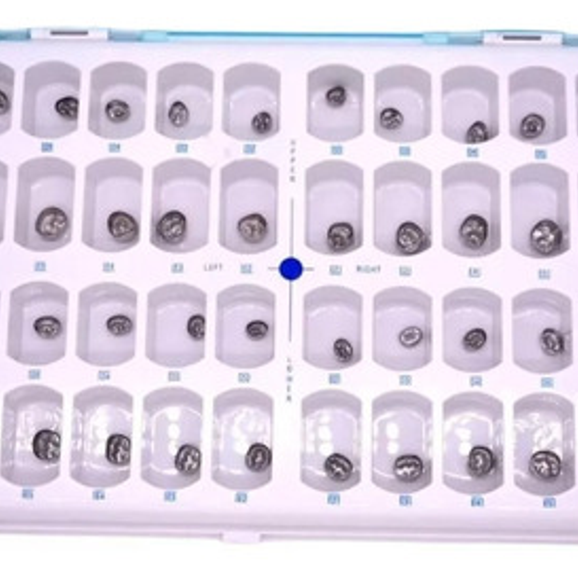 Set Coronas Metálicas Pediátricas Dental 48 Piezas Calidad 2