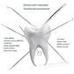 Set Xl Examen Dental Cuchareta Espátulas Y Más 6 Con Estuche Rosa - Miniatura 3