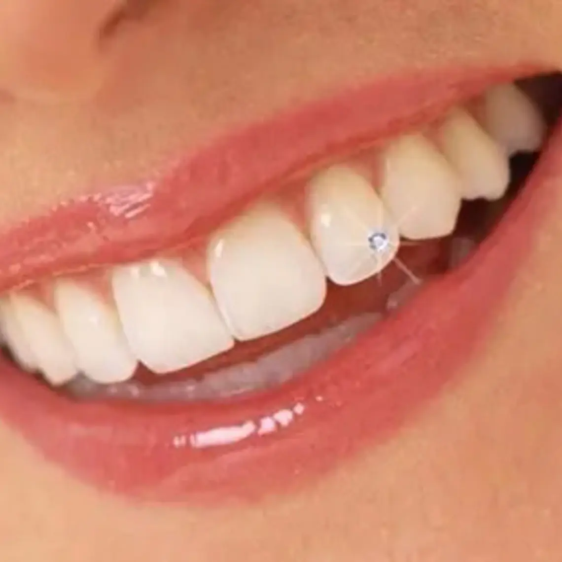 Piercing Dental Cristales Lapidados Set 10 Unidades N°3 3
