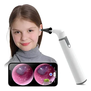 Otoscopio Inalámbrico Wifi Cámara Oído Luz Led Recargable Color Blanco