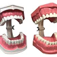 Modelo Anatómico Dental Grande 28 Dientes + Cepillo Pacard - Miniatura 2