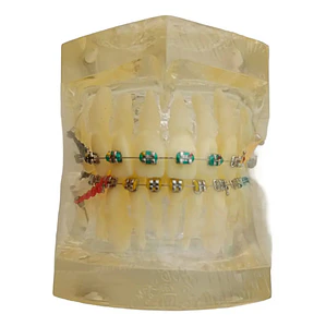 Modelo Dental Ortodoncia Brackets Normal Acrílico Transp