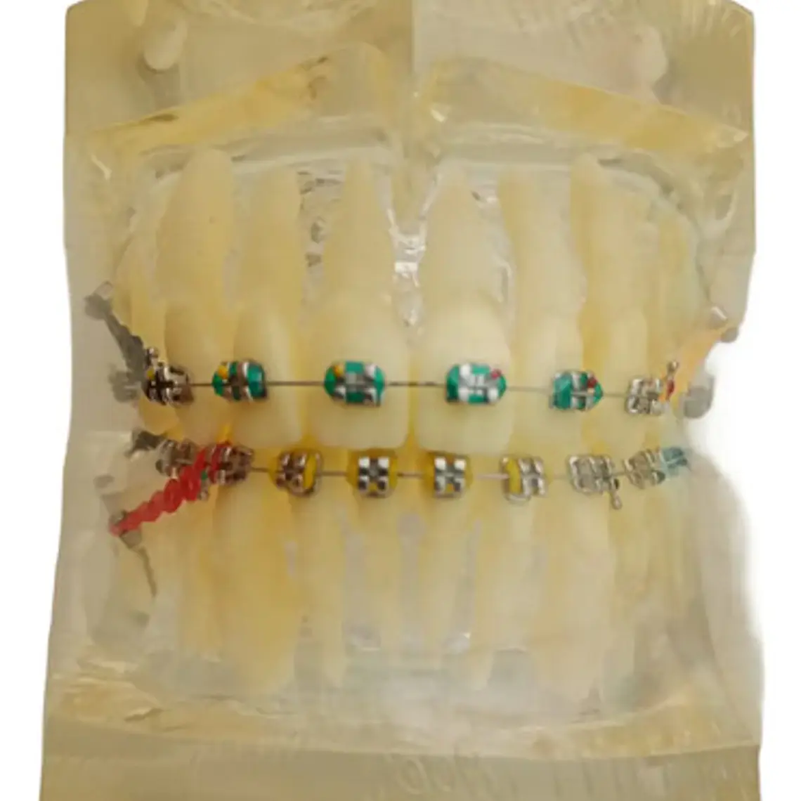 Modelo Dental Ortodoncia Brackets Normal Acrílico Transp 1