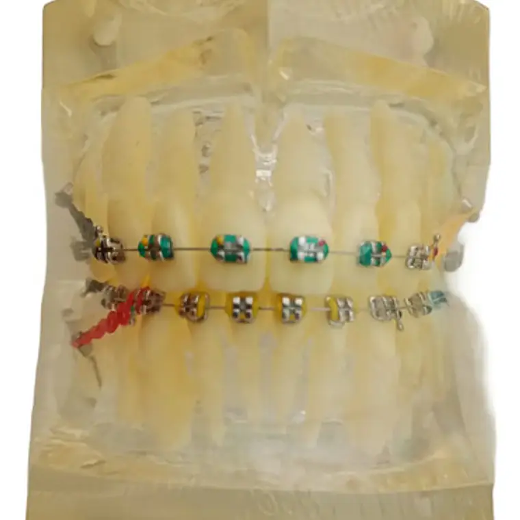 Modelo Dental Ortodoncia Brackets Normal Acrílico Transp 1