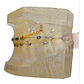 Modelo Dental Ortodoncia Brackets Normal Acrílico Transp - Miniatura 3