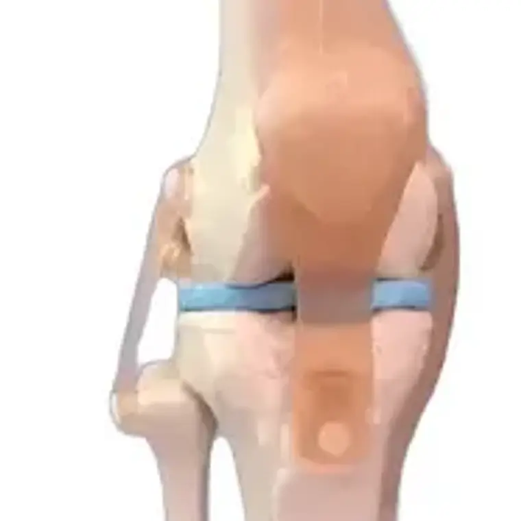 Modelo Anatómico De Rodilla Con Ligamentos, Para Estudio Y Enseñanza 6