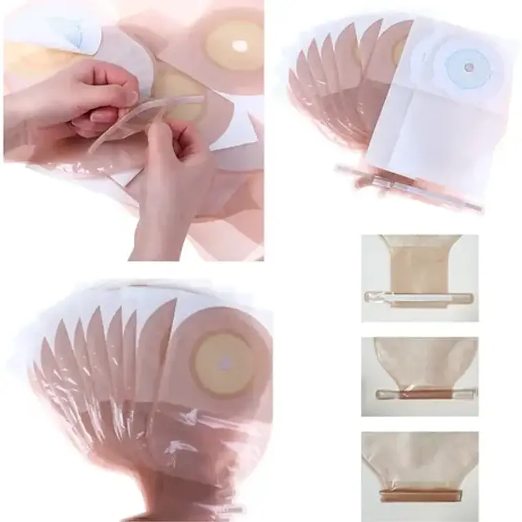 10x Bolsa Colostomía Drenable Con Filtro Anti Olor Y Gases 7