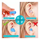 Tapones Oido Silicona Hipoalergénica Moldeable 3 Pares Stgo - Miniatura 4
