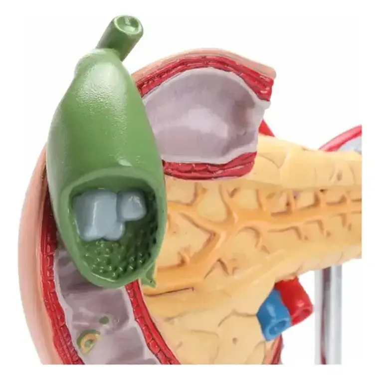 Modelo Patológico De Páncreas Vesícula Duodeno Bazo 20cms 4