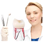 Molar Para Práctica Endodoncia Enseñanza Santiago - Miniatura 1