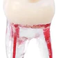 Molar Para Práctica Endodoncia Enseñanza Santiago - Miniatura 2