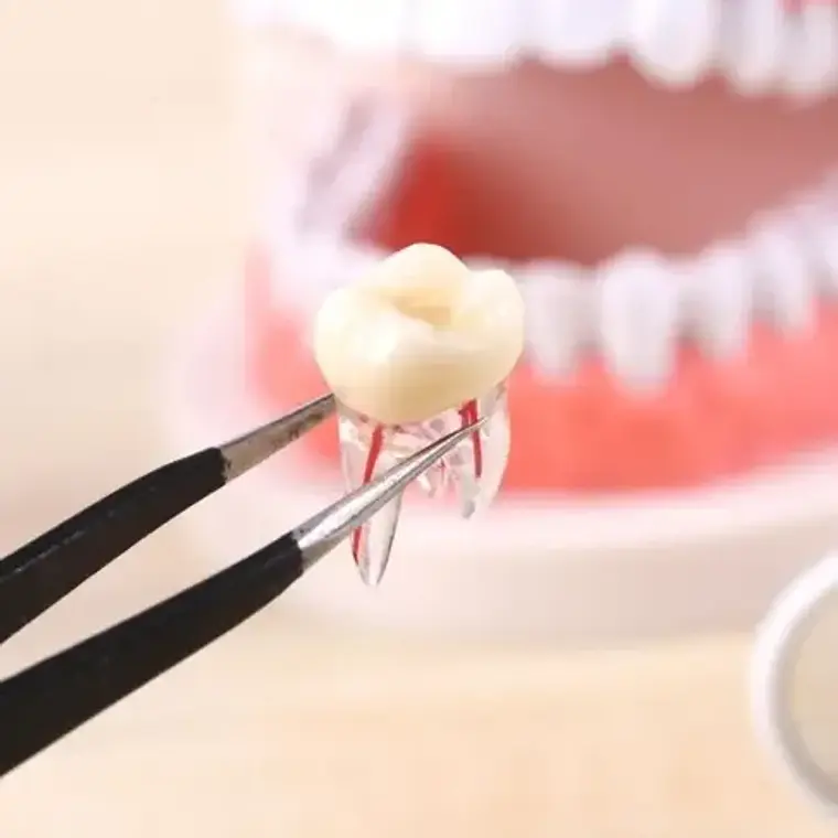 Molar Para Práctica Endodoncia Enseñanza Santiago 4