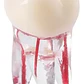 Molar Para Práctica Endodoncia Enseñanza Santiago - Miniatura 9