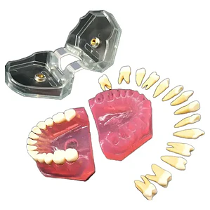 Modelo Acrílico Único Dientes Desmontables Encía Enseñanza