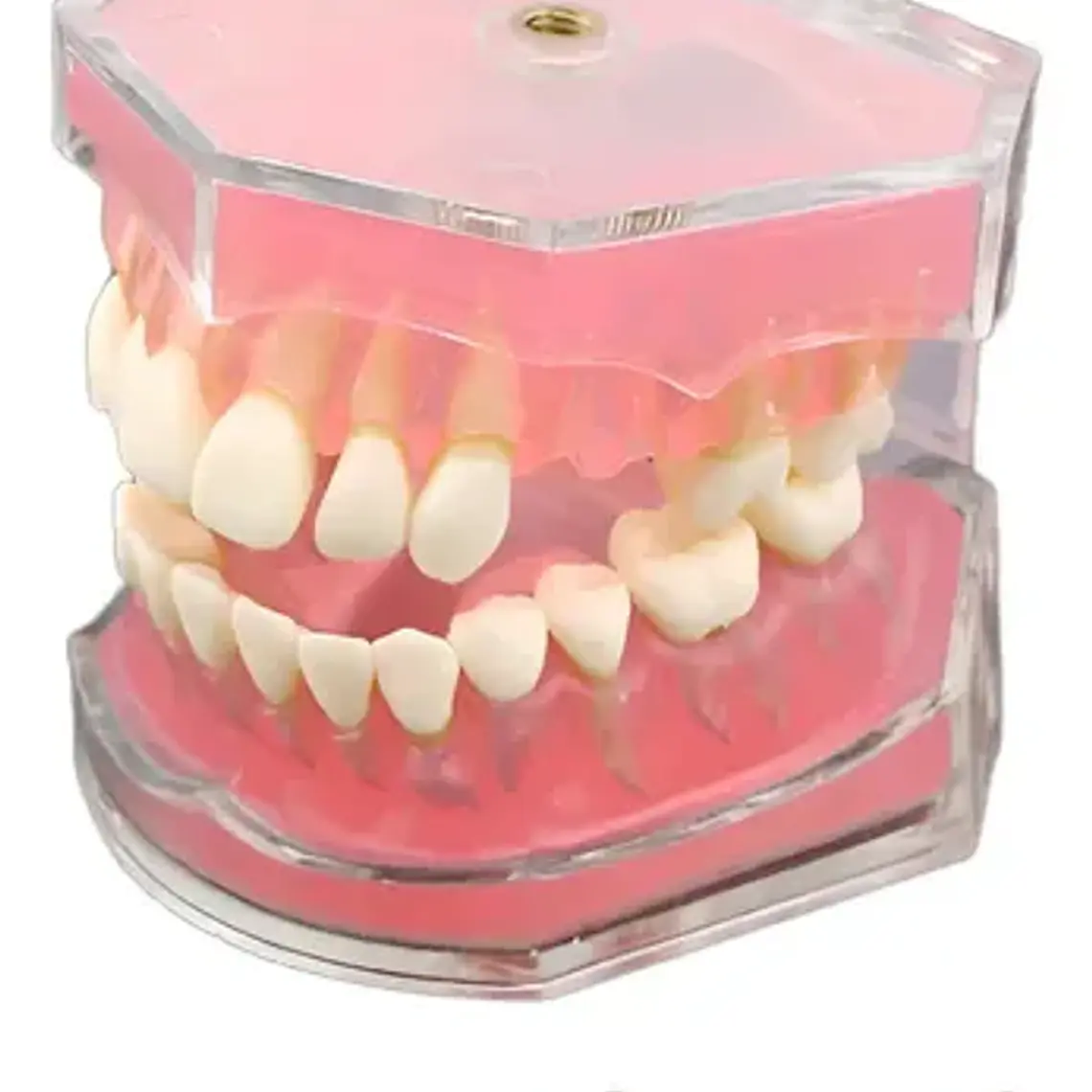 Modelo Acrílico Único Dientes Desmontables Encía Enseñanza 2