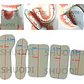 Espejos Intraorales Fotografia Dental Simportas Santiago - Miniatura 6