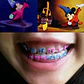 Ligaduras Ortodoncia De Mickey Mouse Colores 1000u Santiago - Miniatura 1