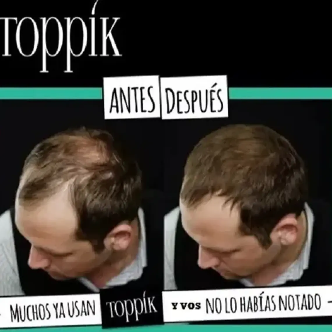 Toppik Pelo En Polvo Frasco Sellado 27.5g Colores Santiago 9
