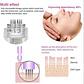 Micro Agujas Especiales Dermapen 1, 3, 5, 7 Y 9 Pin Santiago - Miniatura 4