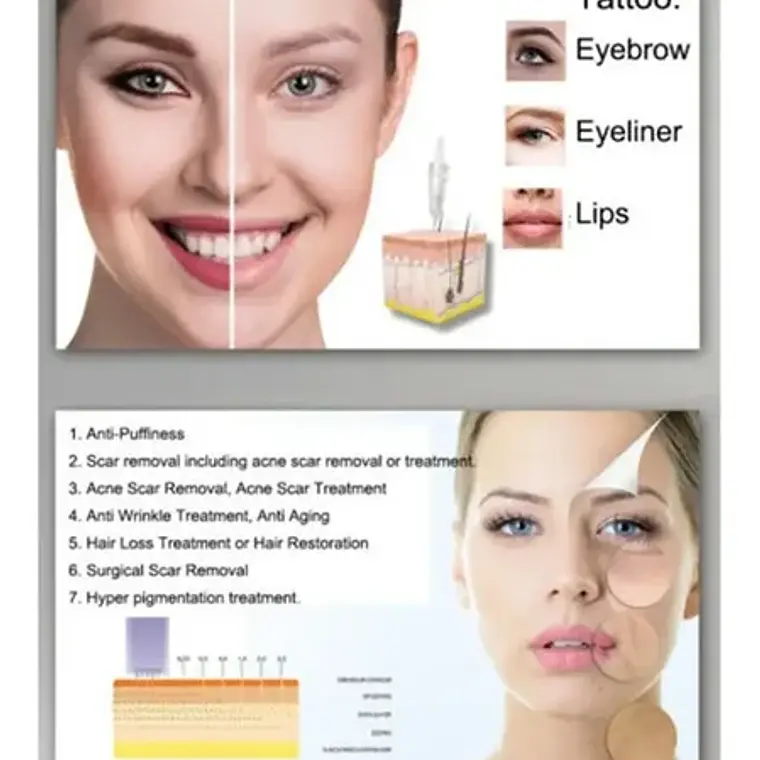 Cartuchos Micro Agujas Dermapen Modelos Simportas Santiago 8
