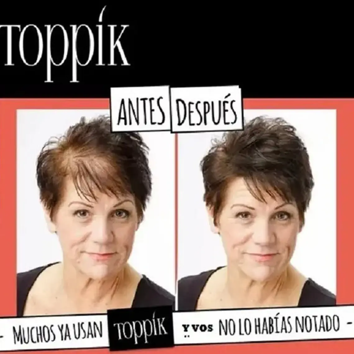 Pack Toppik Microfibras De Queratina + Aplicador Difusor 9
