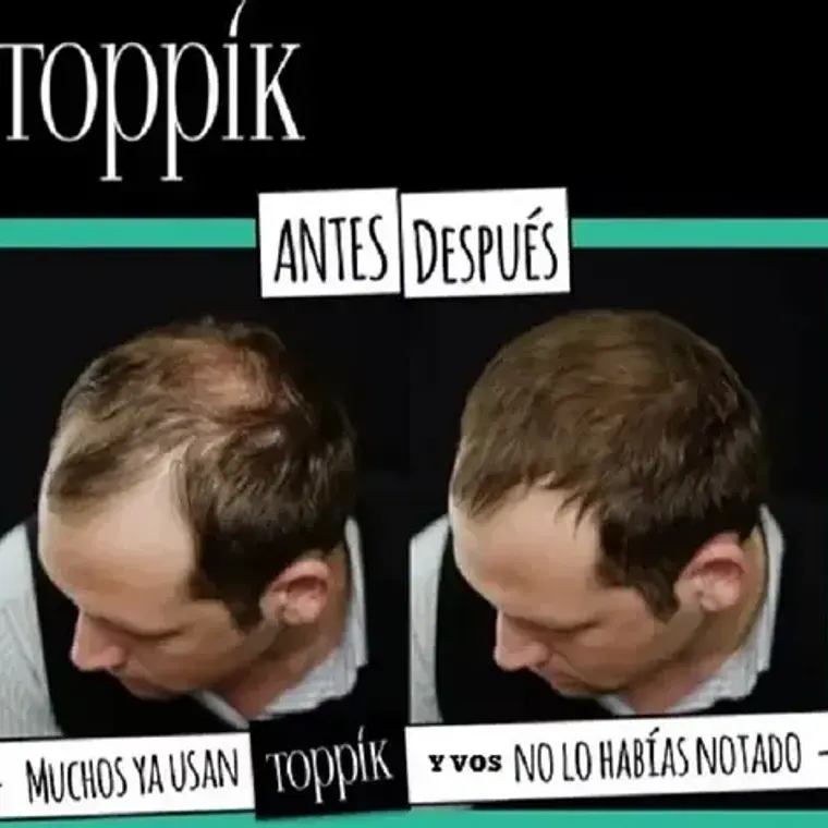 Pack Toppik Microfibras De Queratina + Aplicador Difusor 14