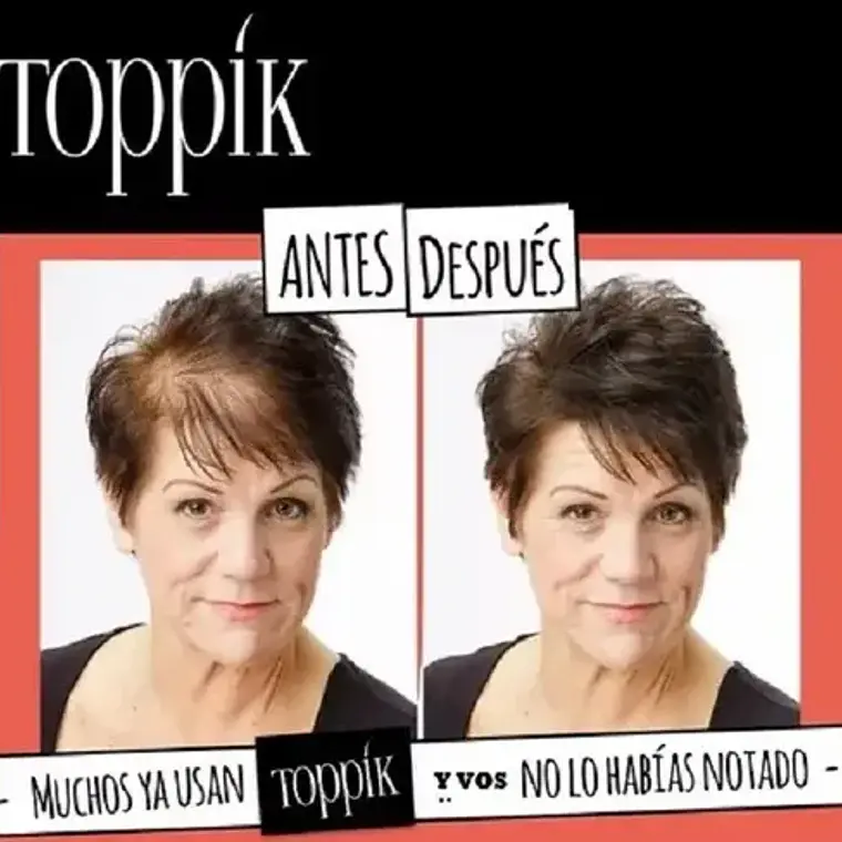 Pack Toppik Microfibras De Queratina + Aplicador Difusor 19