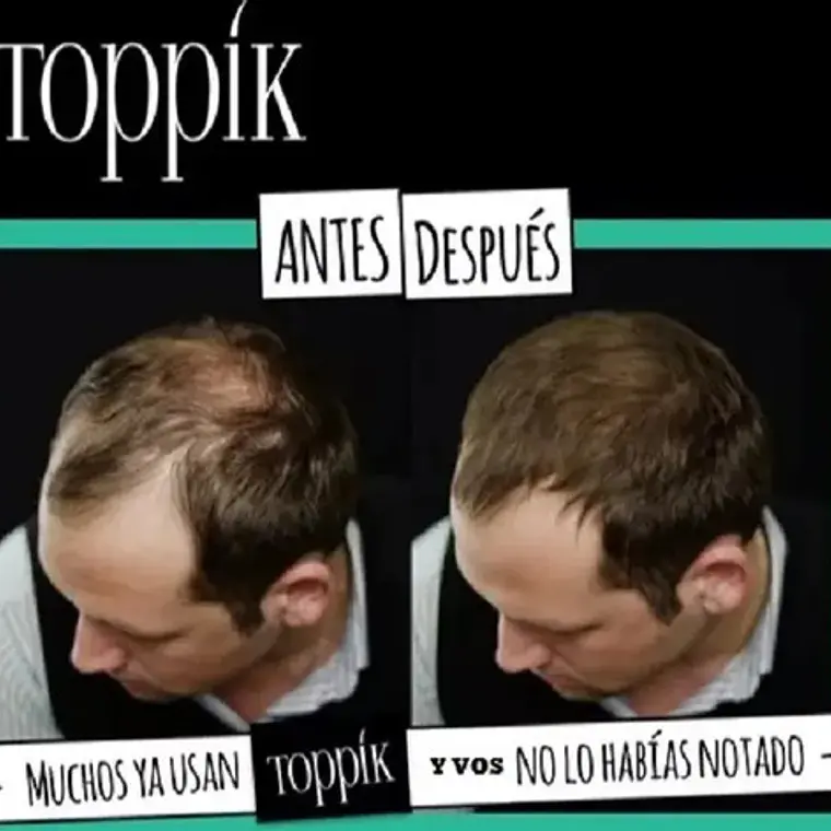 Pack Toppik Microfibras De Queratina + Aplicador Difusor 34
