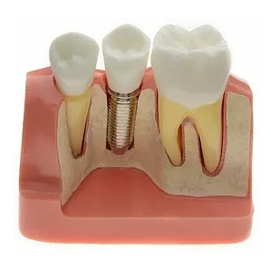 Modelo Dental Enseñanza Y Estudio Puente Gigante Santiago
