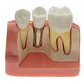 Modelo Dental Enseñanza Y Estudio Puente Gigante Santiago - Miniatura 1